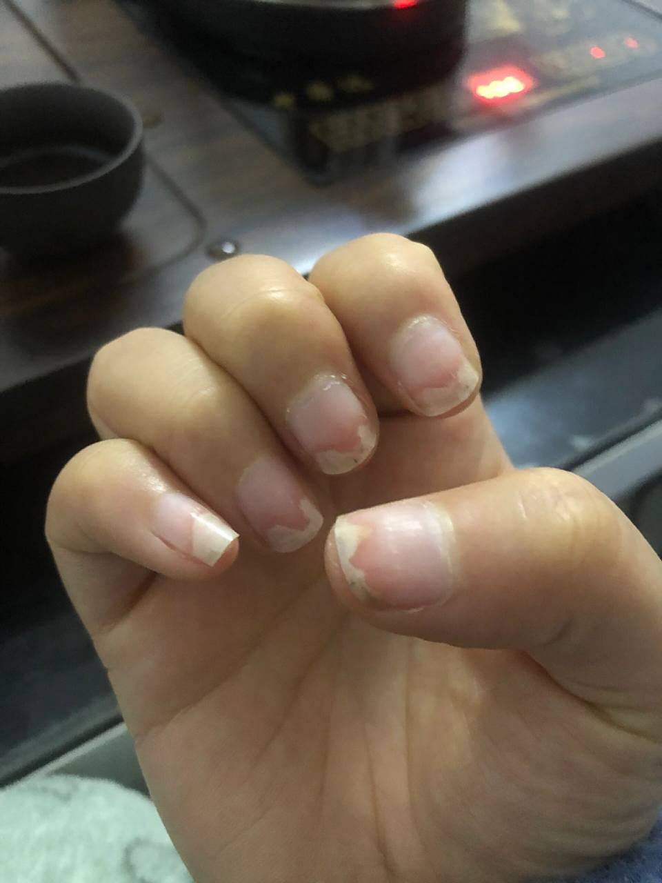 因为自己暴力卸甲,导致指甲空甲了,好疼呀,洗脸碰到水都很疼,听朋友说