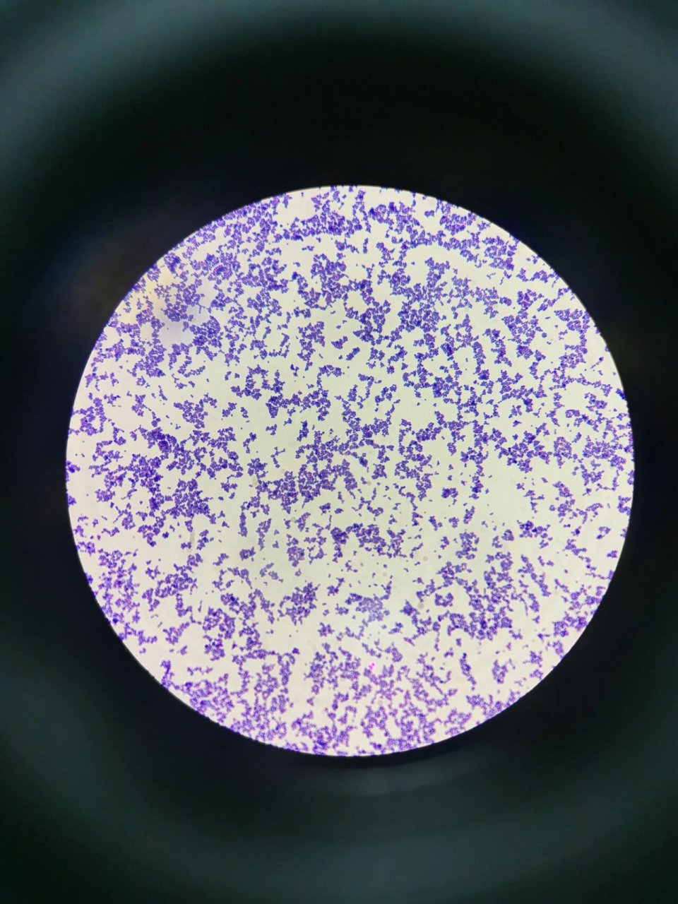 医学生进来认细菌啦 今天做了两种细菌的革兰染色,大家看看分别是哪