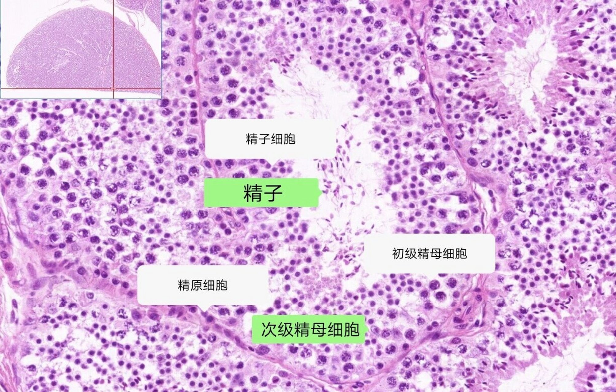男性生殖系统——睾丸 生精小管相关结构 精原细胞:紧贴基膜,圆形或卵