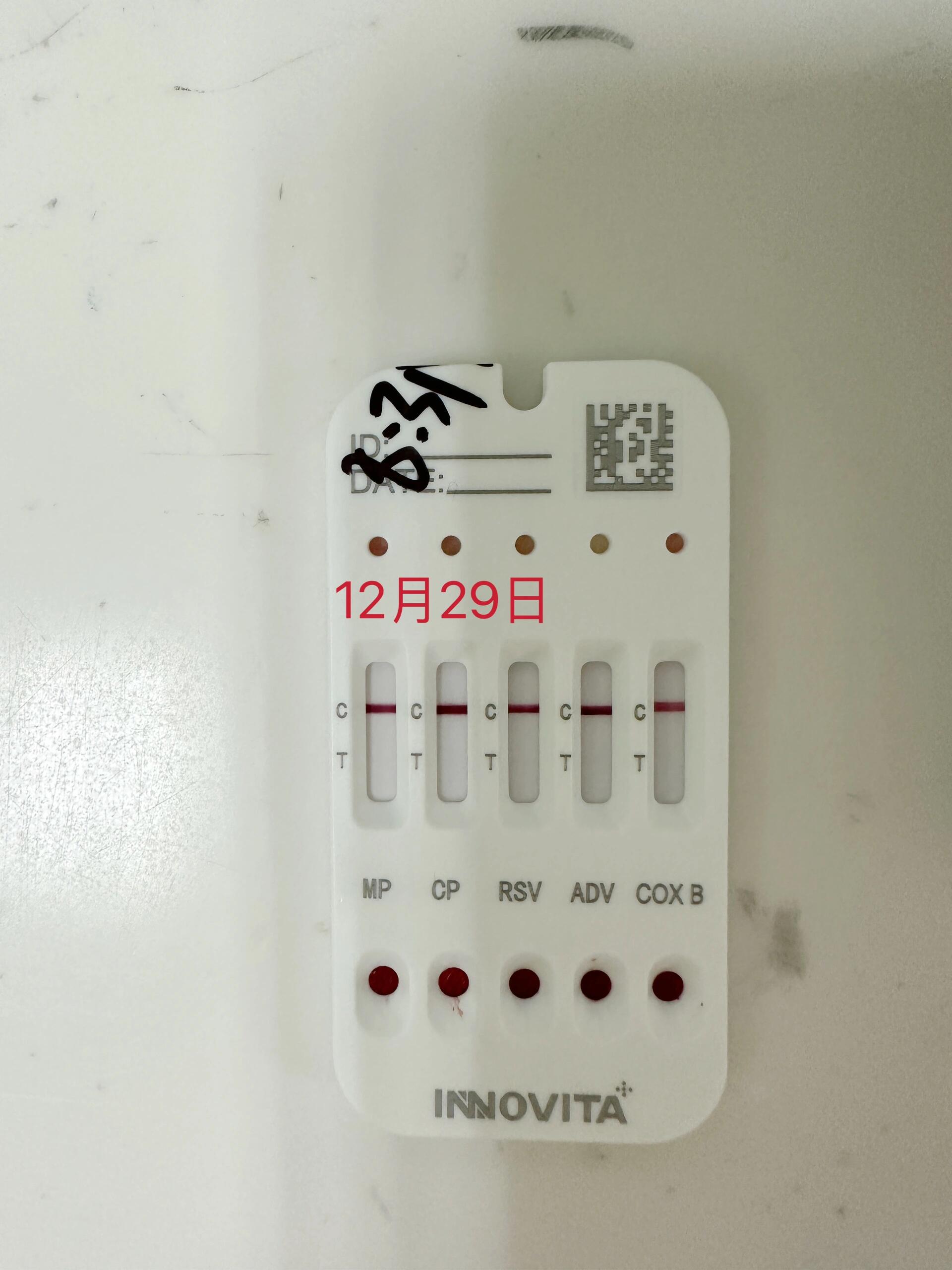 儿童支原体阳性图片