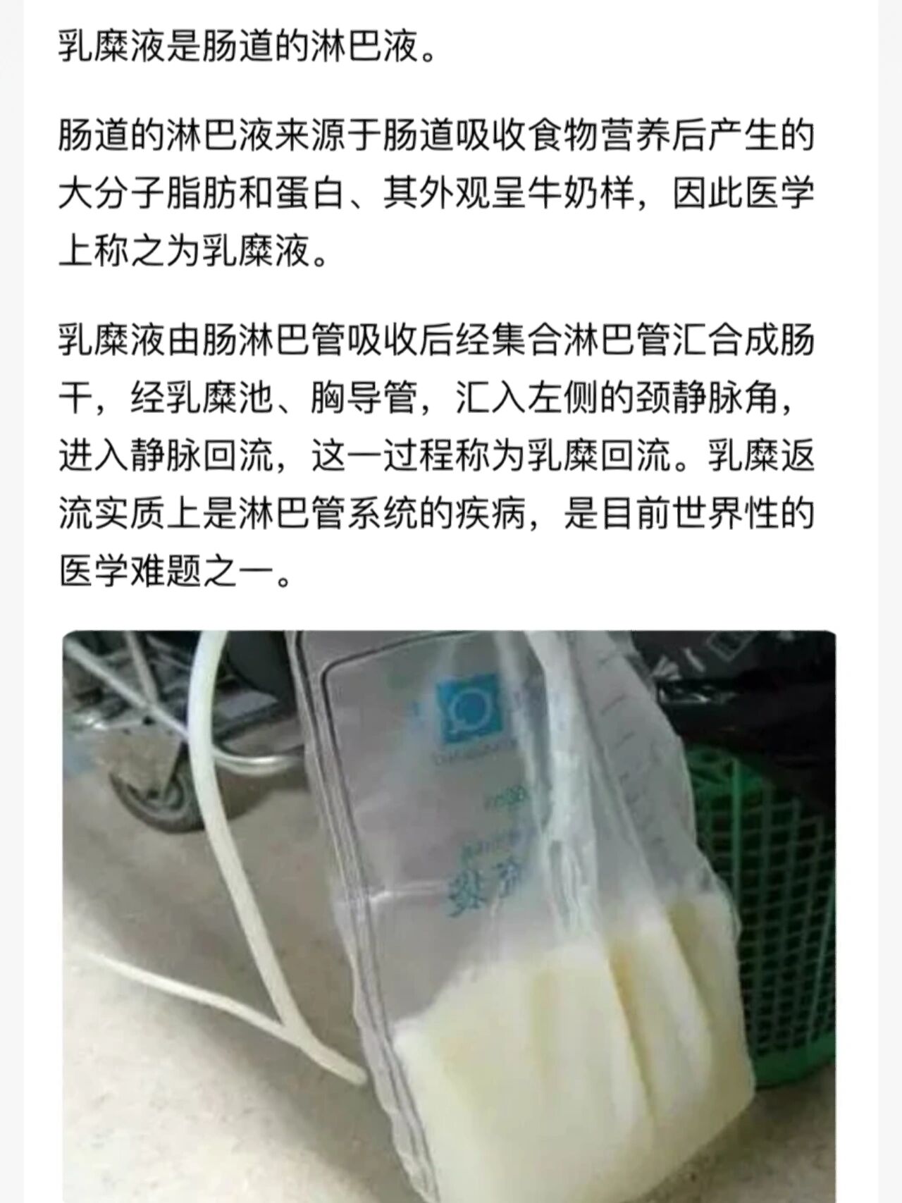 乳靡液 乳糜尿 1,乳糜液:肠道的淋巴液 2,肠道淋巴液:源于肠道吸收