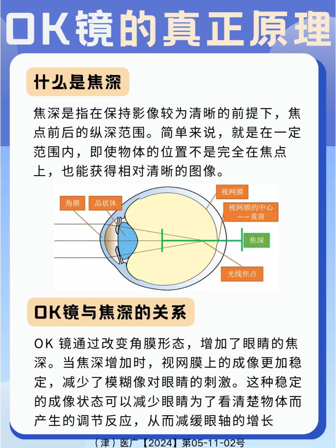 是通过离焦环的近视离焦作用控制眼轴向