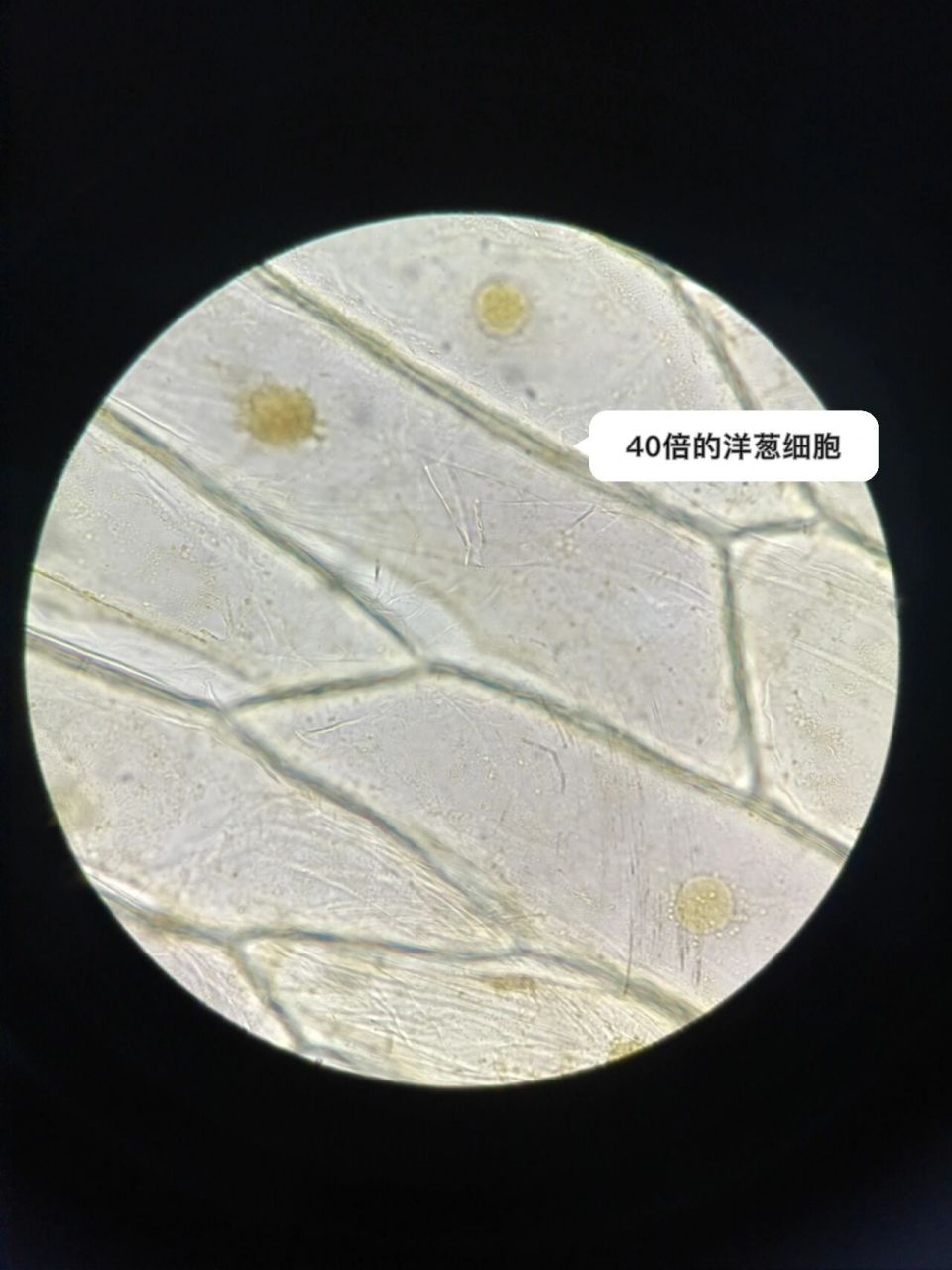显微镜下的口腔上皮细胞洋葱细胞红细胞