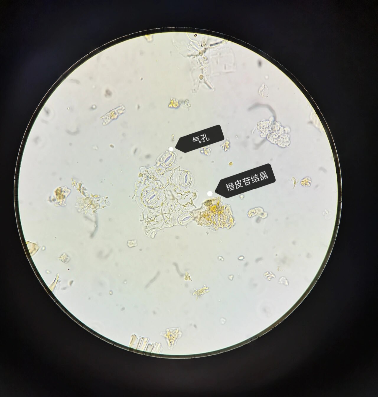 薄荷粉末显微鉴别 1.非腺毛 2.气孔 3.橙皮苷结晶 4.腺鳞