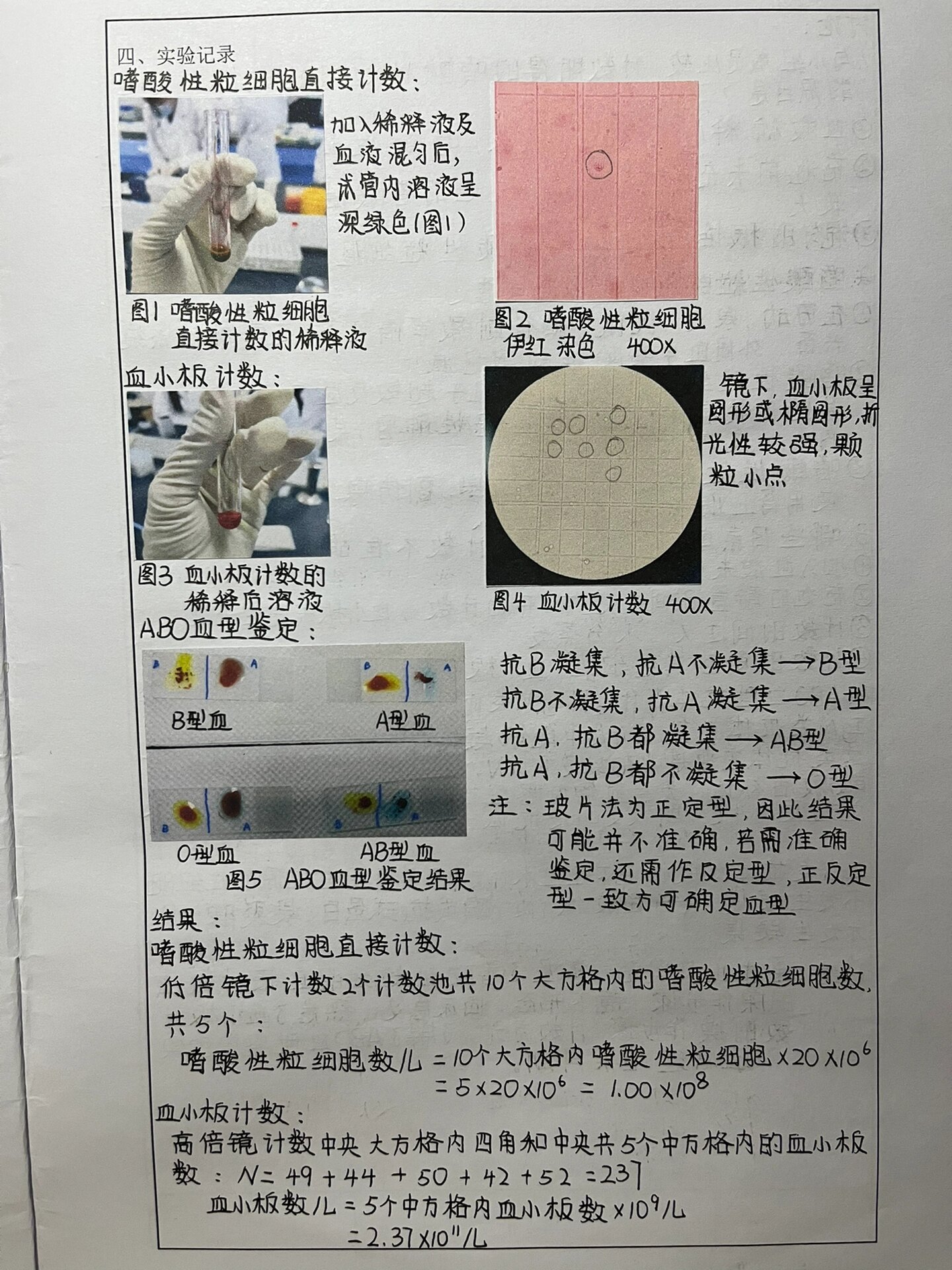 血小板手工计数图片