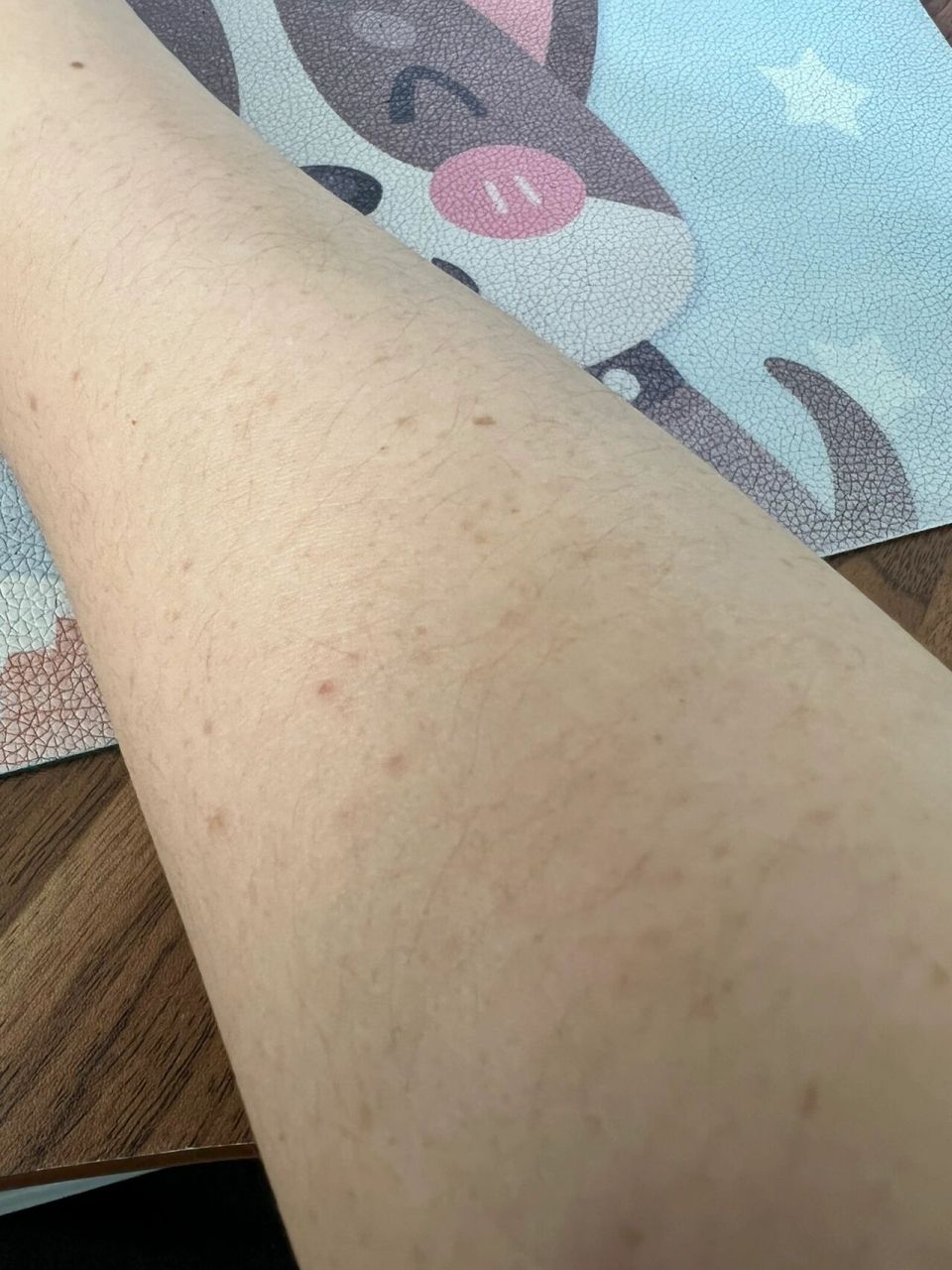 手臂上好多这样斑一样的东西,年轻的时候没有,现在好像慢慢开始多起来