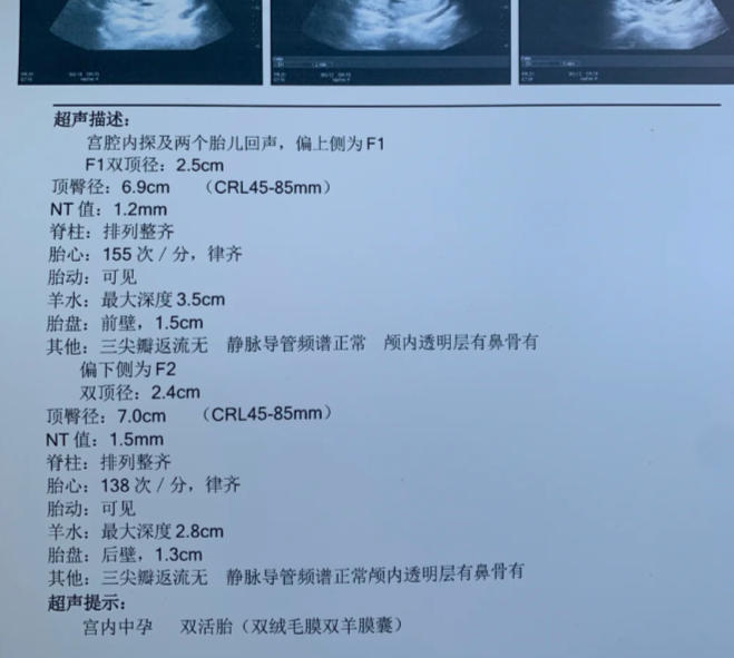 阜外医院代诊挂号服务检验结果异常及时告知，早做处理的简单介绍