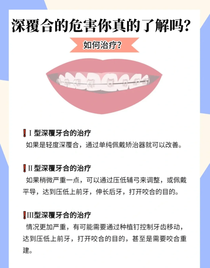 深覆合是一种上下颌牙弓(或)上下颌骨垂直向发育异常所致的错颌畸形.