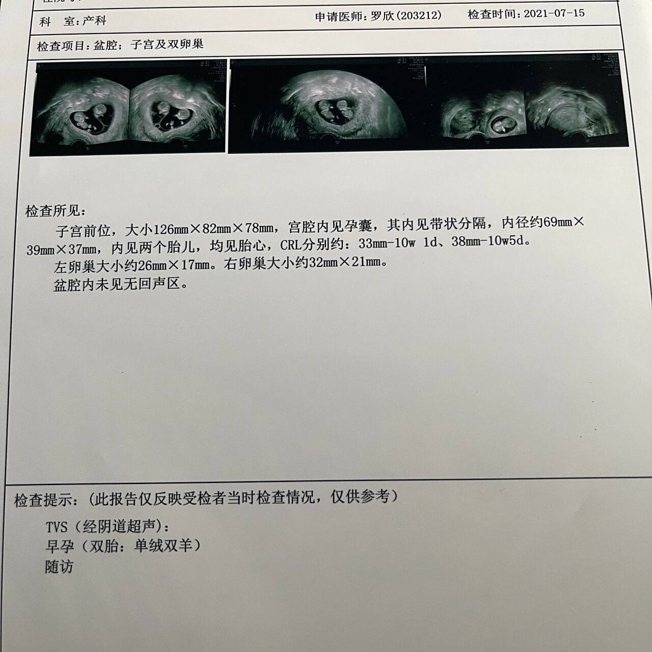 单绒双羊有龙凤胎几率嘛?没有我希望是二个可爱女鹅