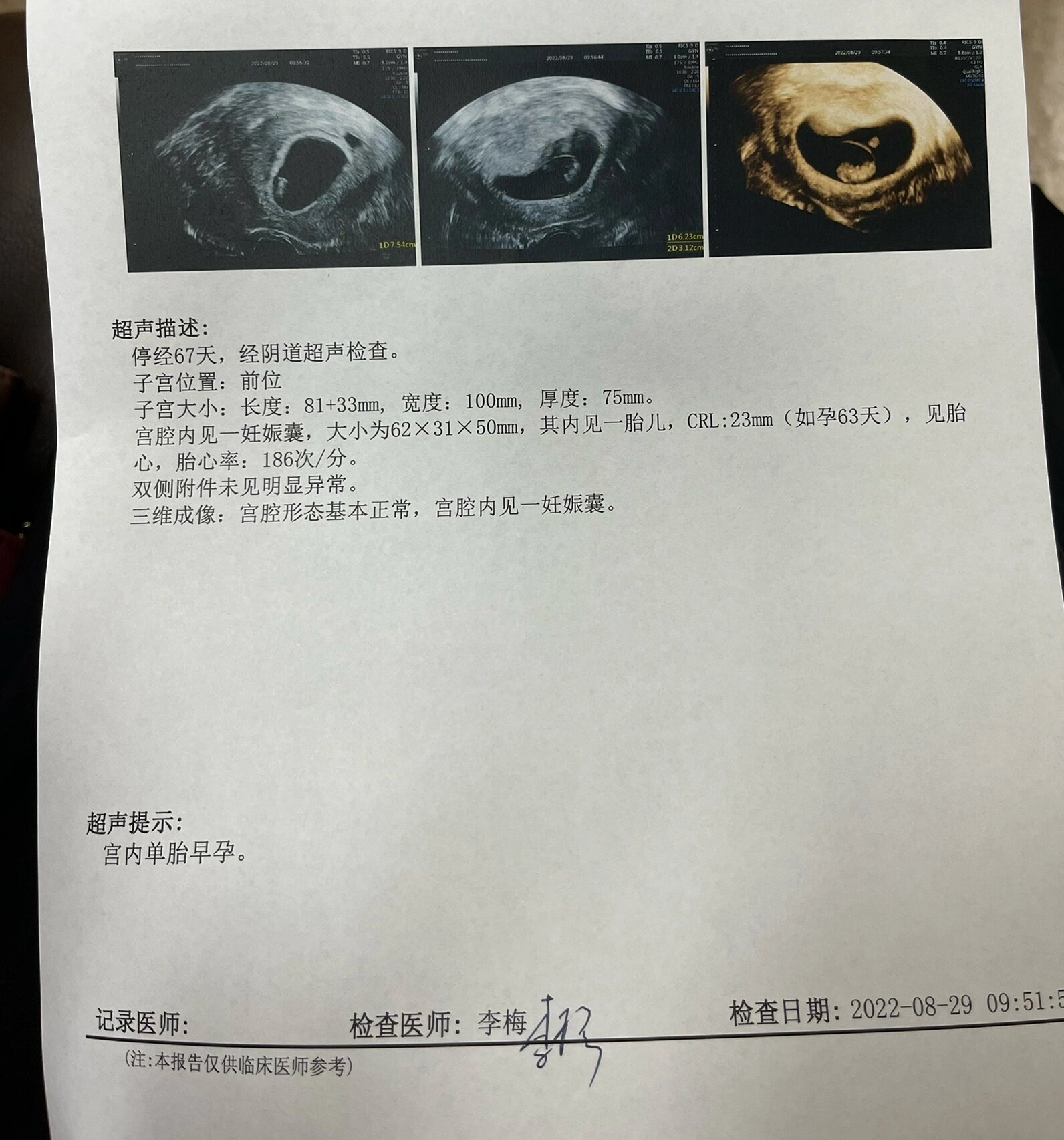 纵隔子宫的姐妹们不要怕 🌸8.