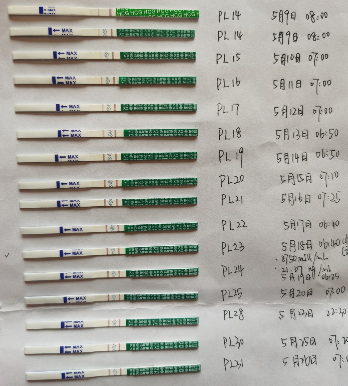 孕反消失 1,排卵14天(5月9日)即本该来大姨妈当天无意测出怀孕; 2