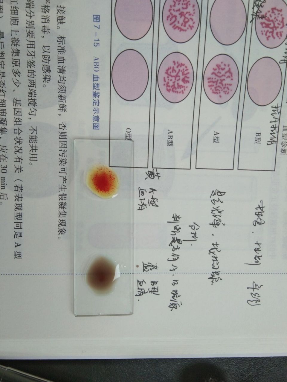 血型化验图片