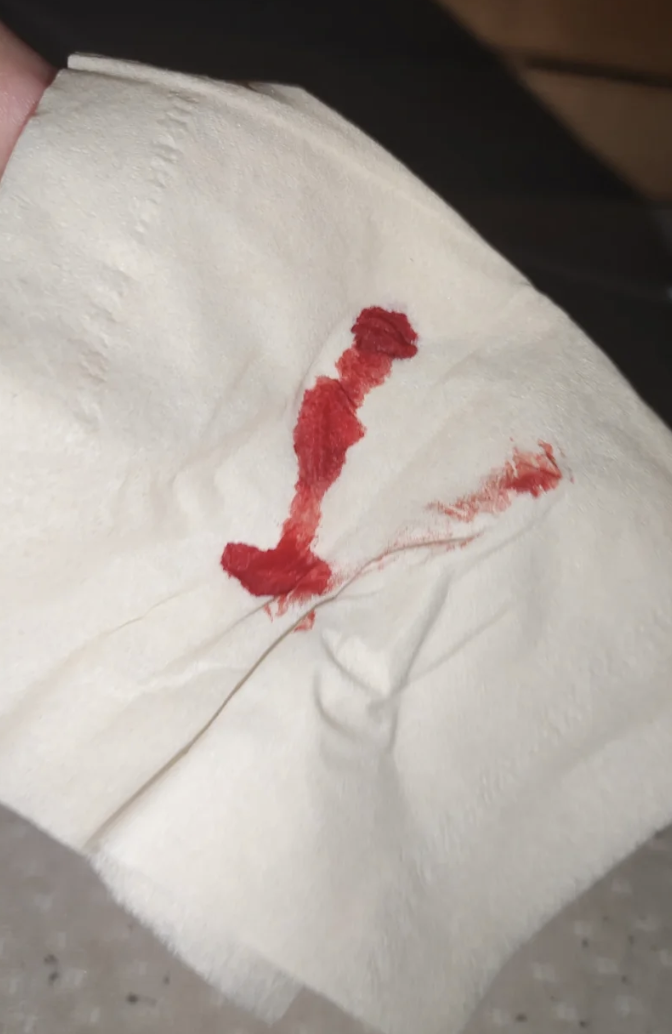 10天是正常的.如果创面比较浅,通常7-10天就能止. 