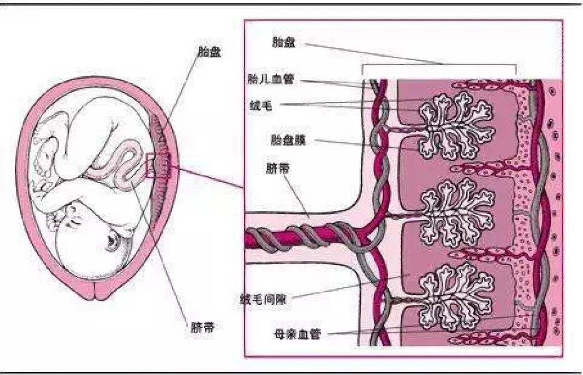 孕期笔记之球拍状胎盘🤰 孕24周大排畸发现球拍状胎盘😢感谢b超