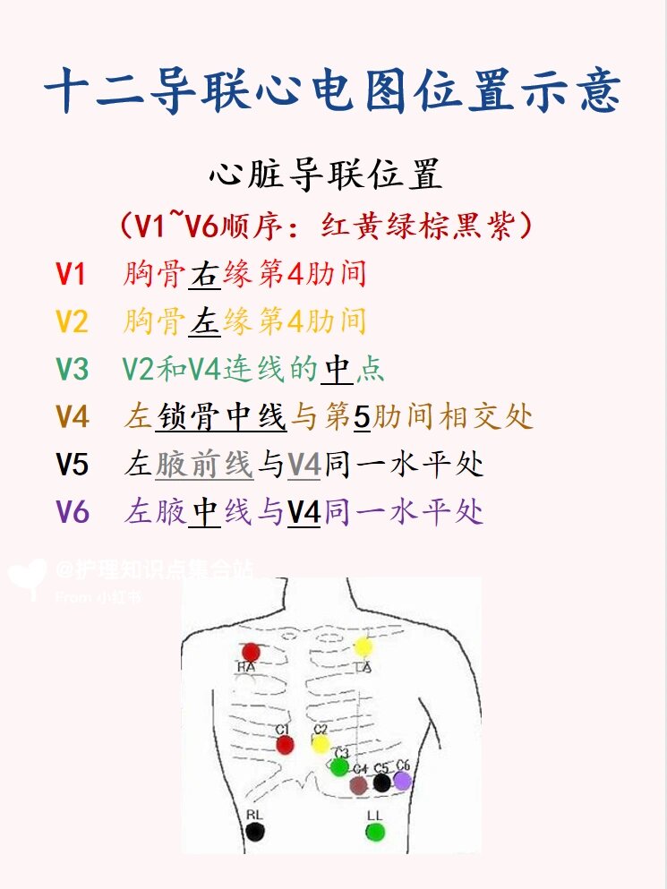 内科|十二导联心电图示意