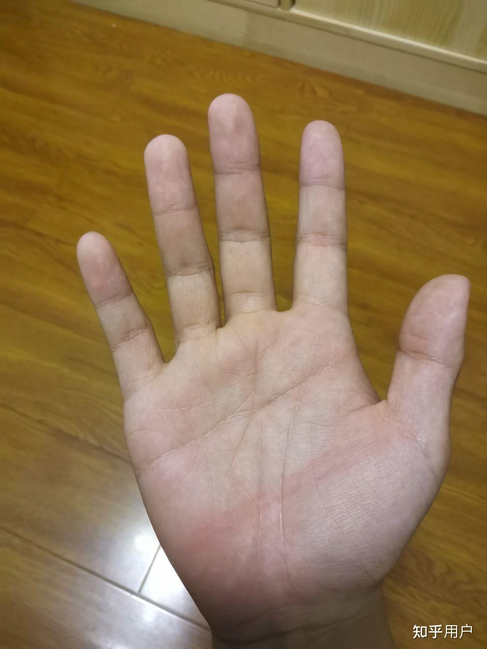 被打手心是种怎样的体验