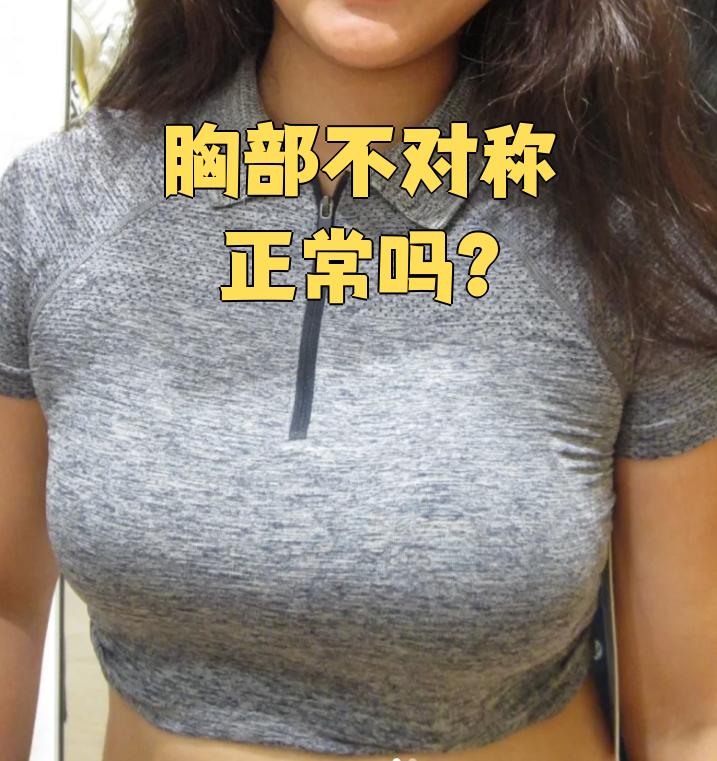 胸部不对称是不是正常,要看具体原因