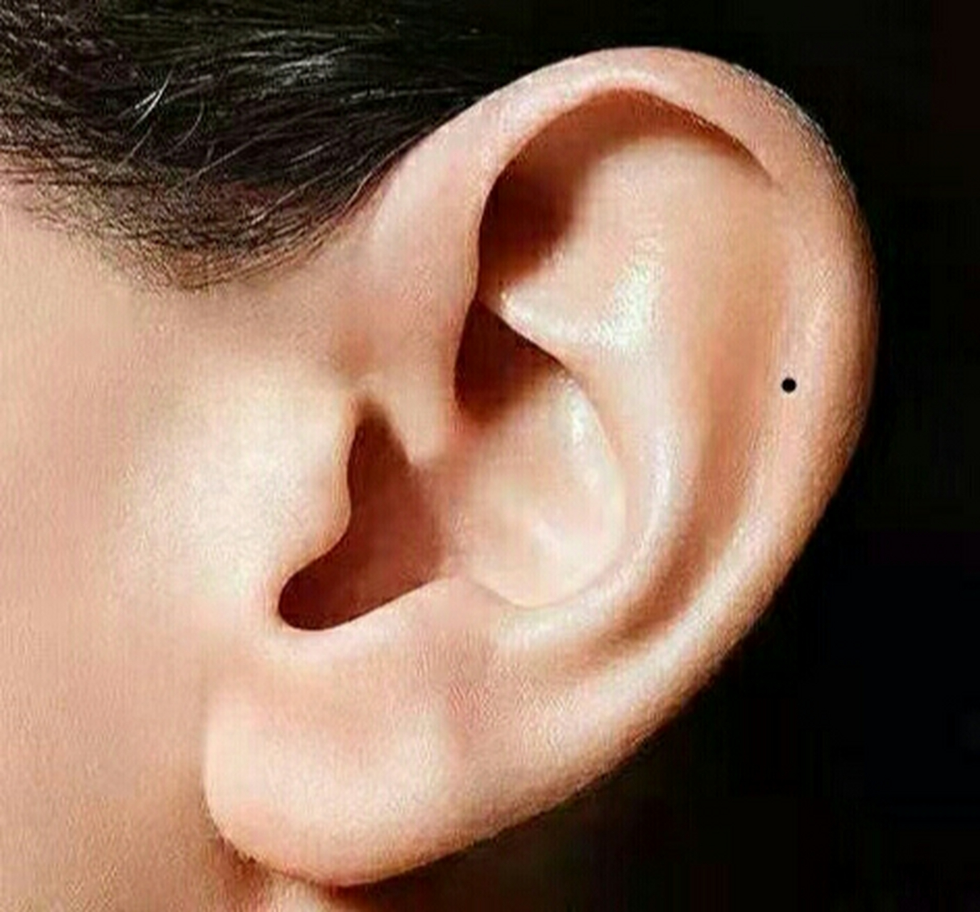 耳朵痣代表什么图解图片