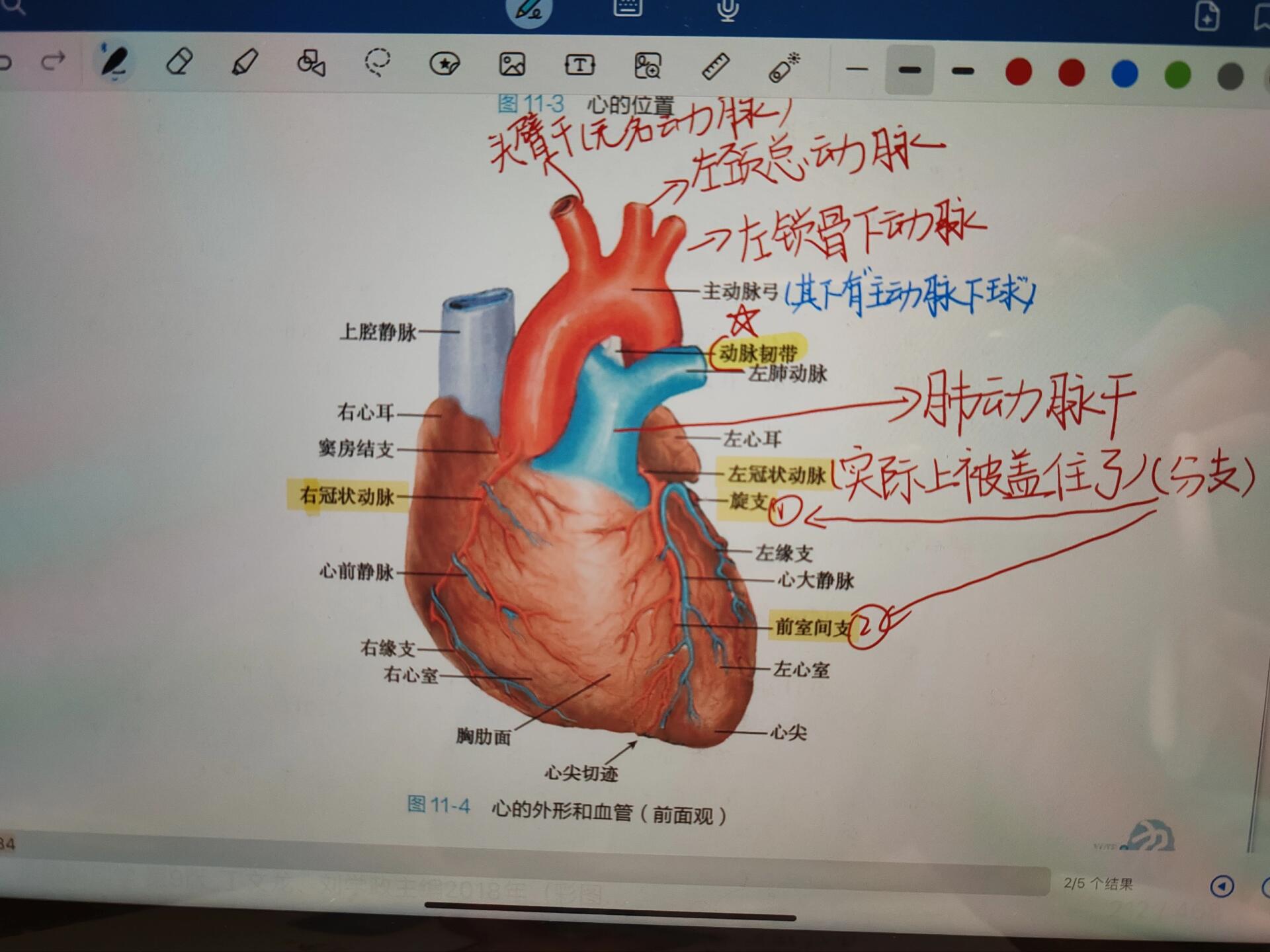 静脉血管窦外观照片图片