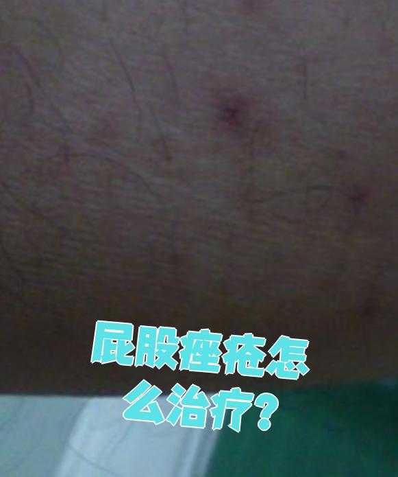 可以通过日常护理,药物治疗和光动力