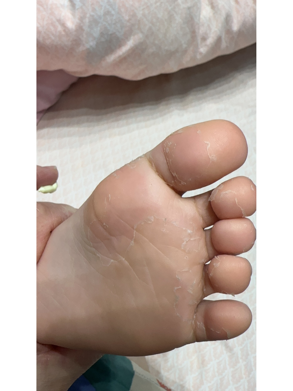 不废话直接说:16615地奈德7726615小儿金施尔康 16615