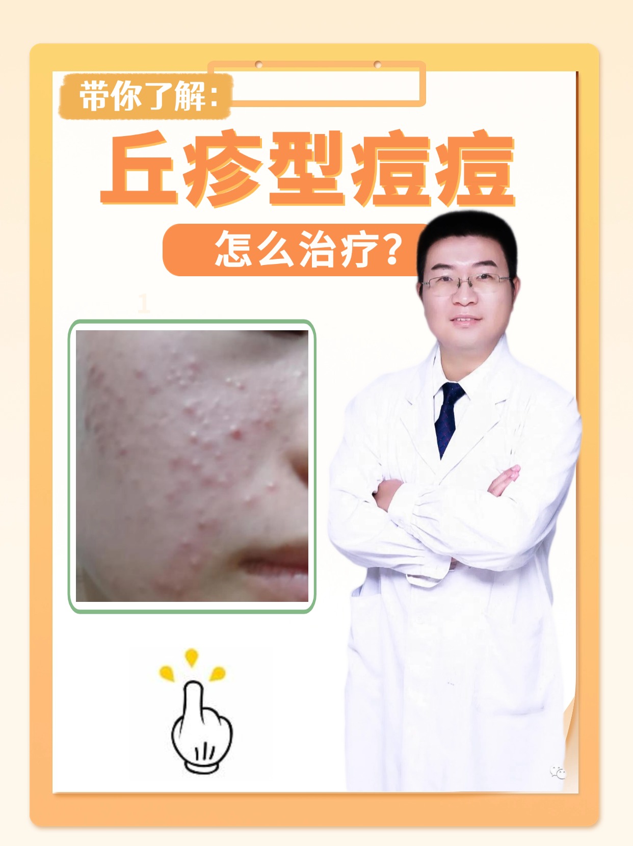 带你了解:丘疹型痘痘怎么治疗?