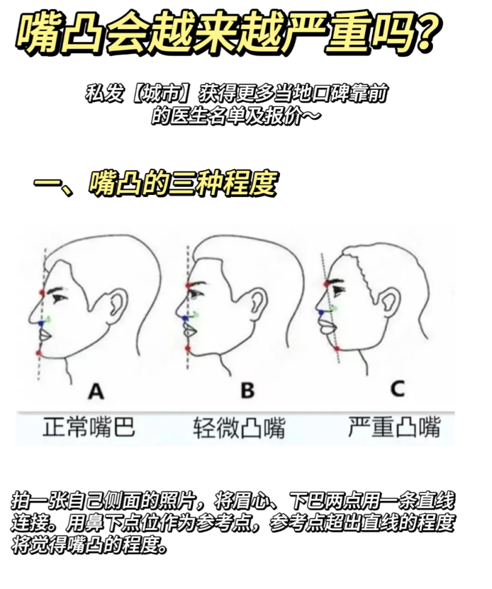 侧脸嘴巴突出怎么办图片