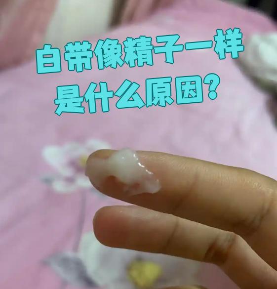 但如果白带颜色变了,还有异味,阴道痒,肚子疼这些症状,那可能是生病了