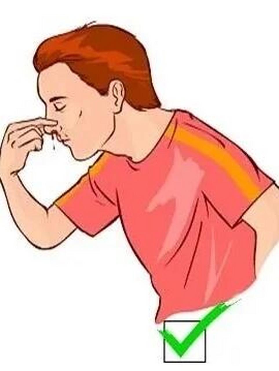 鼻子是人体最易受伤的部位之一,90%的儿童鼻出血发生在鼻中隔前下区