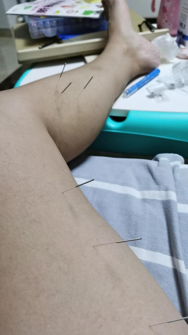 针灸练习 气血三针,肾元三针,木针,土水穴,解郁针