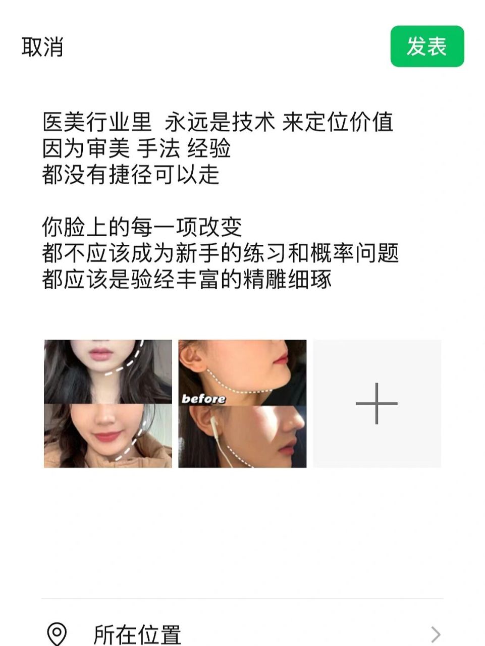 医美朋友圈文案这样发/走心文案激活顾客 医美行业里  永远是技术 来