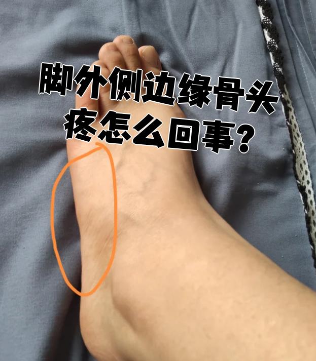 脚外侧边缘骨头疼常见原因包括外伤,骨性关节炎,痛风,类风湿性关节
