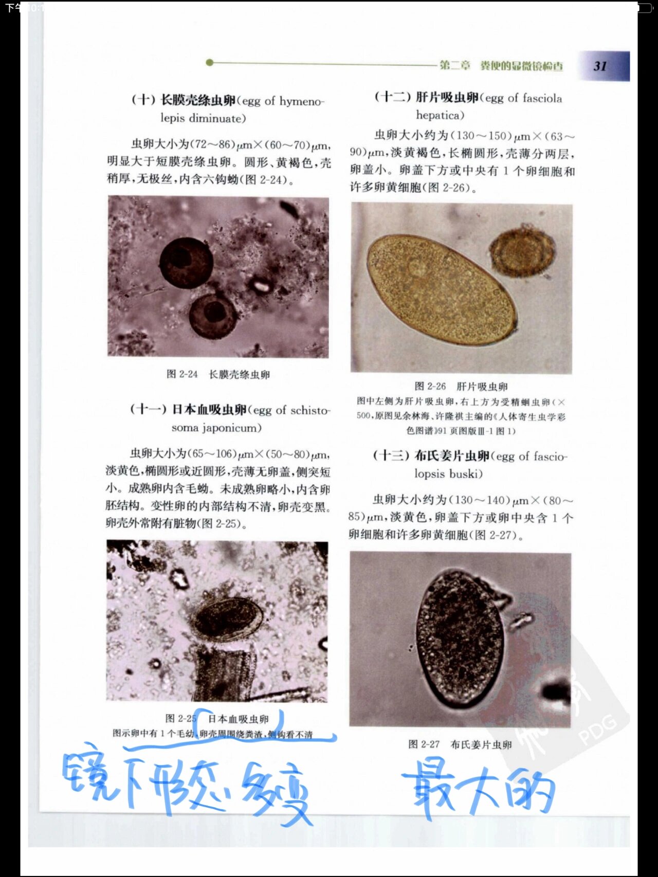 肛门饶虫卵图片