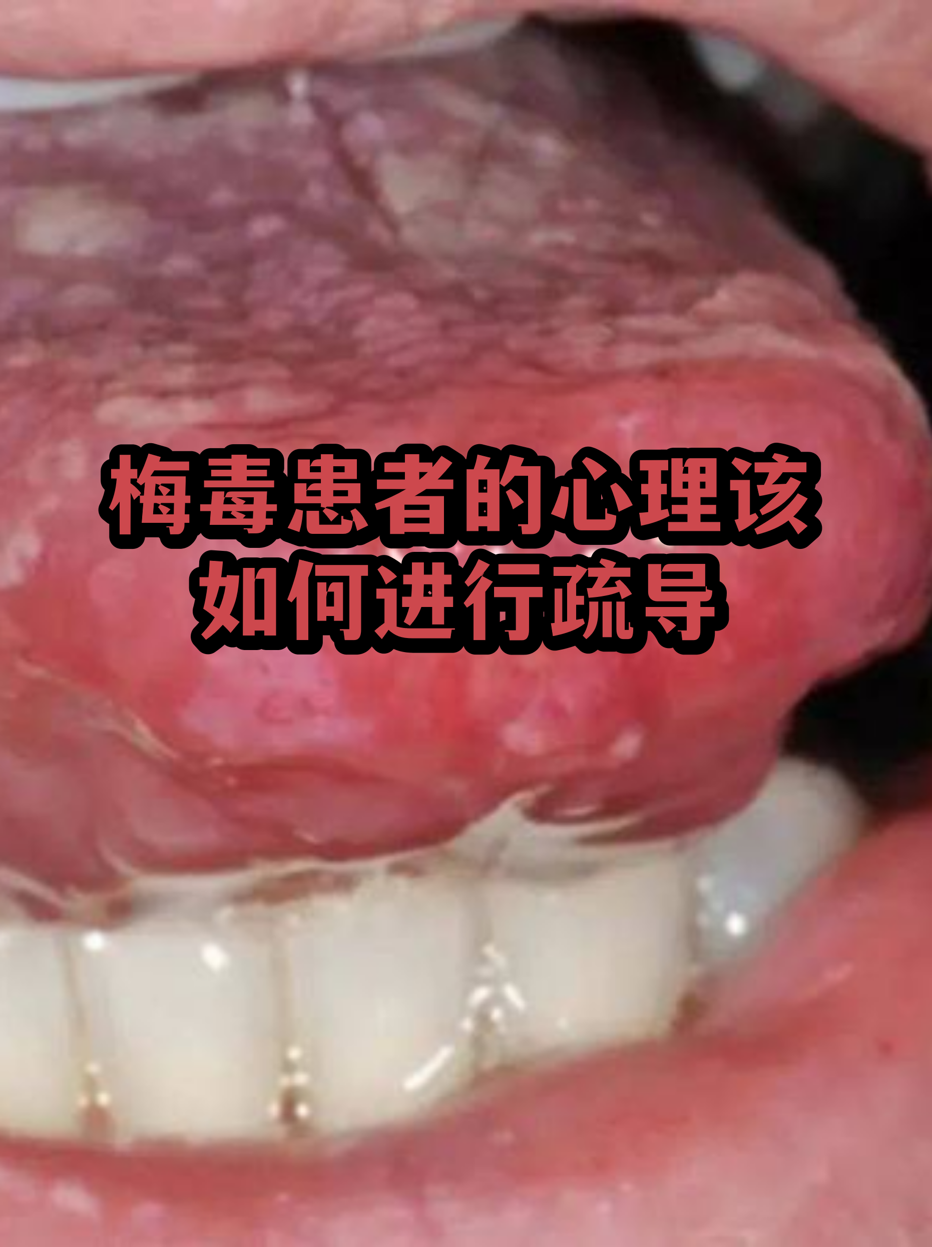  疫情后的心理建设(疫情期间心理疏导)