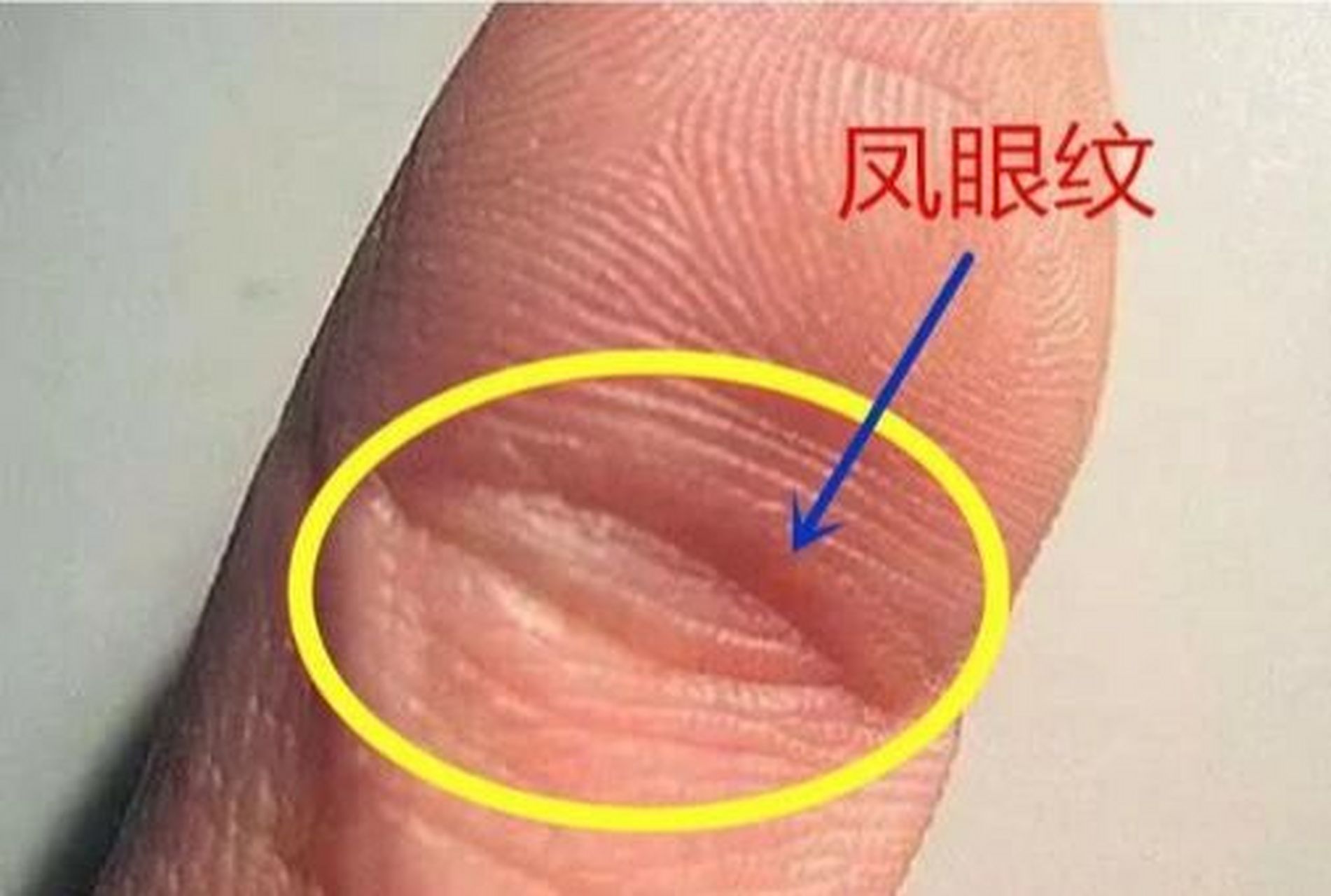 凤眼纹好在哪 在拇指蒂一节指节上面的指纹呈一个圈行的纹路叫做凤眼
