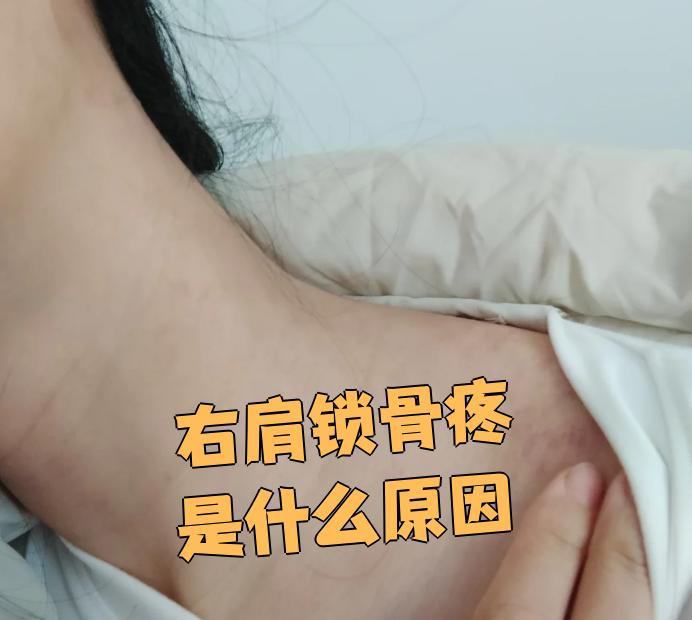 右肩锁骨疼是什么原因