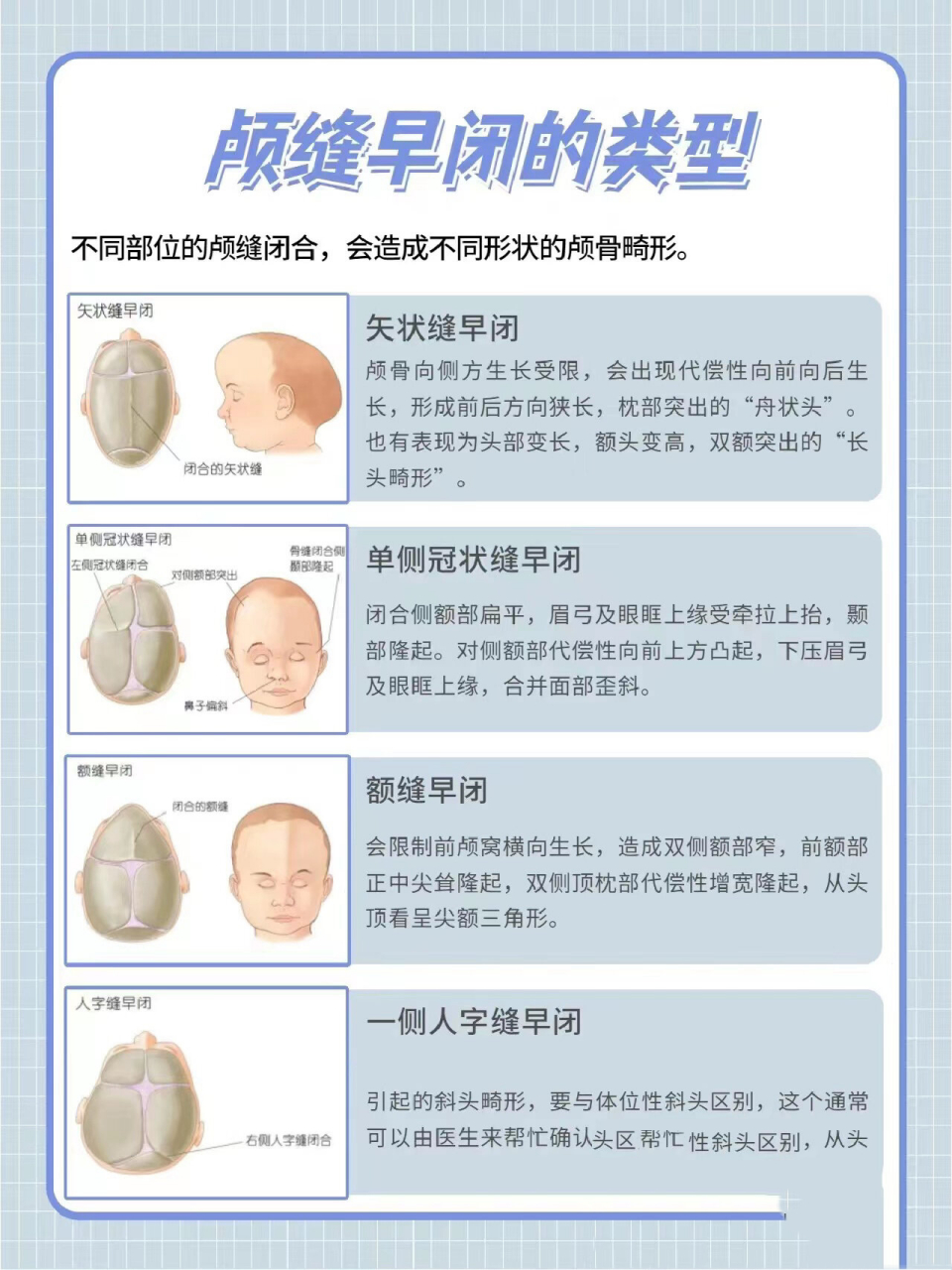 颅缝早闭矢状缝的判断及头型类型 宝妈们问我舟状头,矢状缝早闭的最多