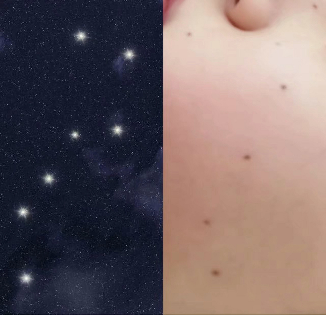 北斗七星痣 真的丑晕,全身的痣都长在了脸上.