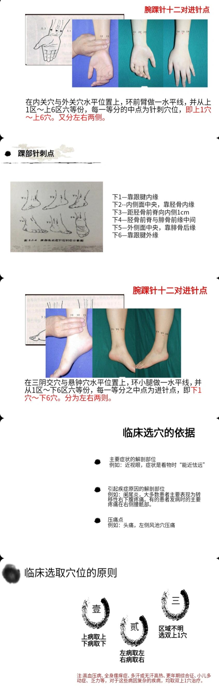 腕踝针的相关知识 腕踝针是一种只在腕踝部特定的针刺点,循着肢体纵轴