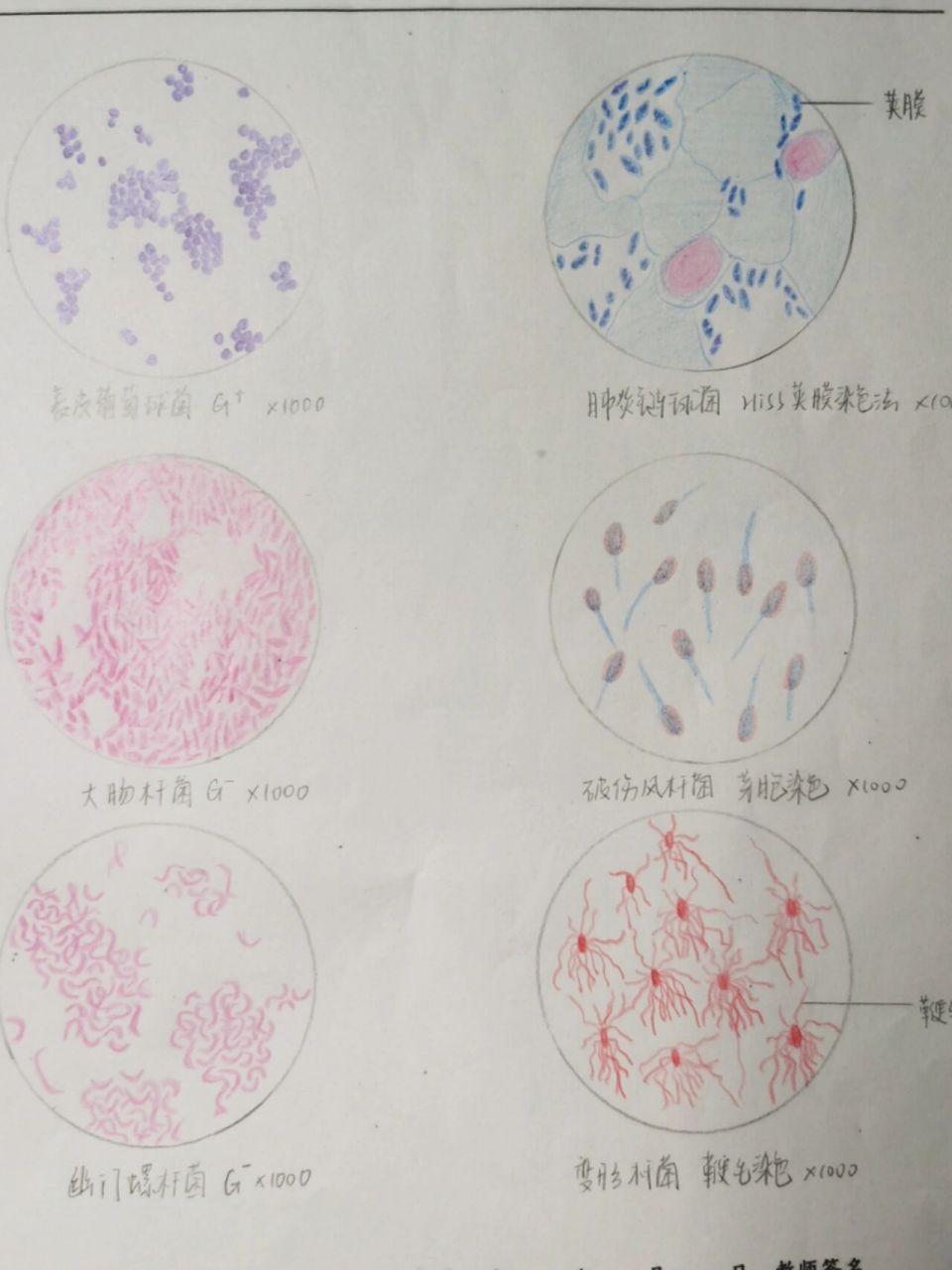 微生物实验红蓝铅笔手绘图 8215表皮葡萄球菌 8215大肠杆菌