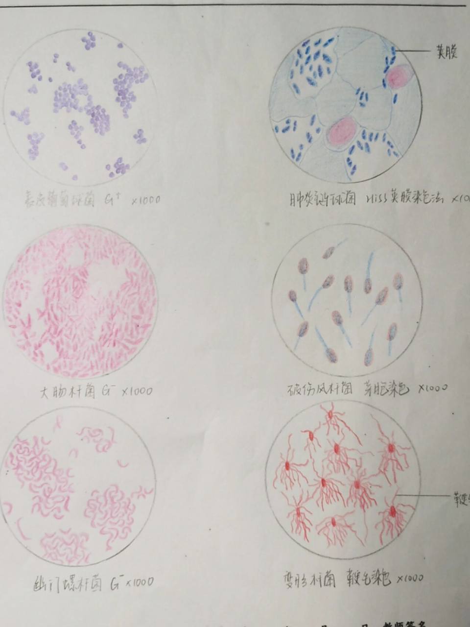 微生物实验红蓝铅笔手绘图 8215表皮葡萄球菌 8215大肠杆菌