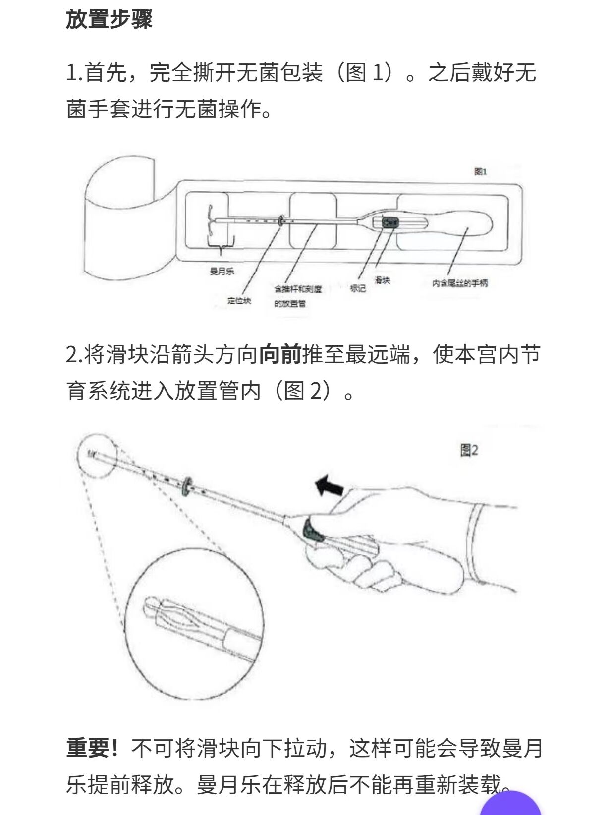 不良反应:在放置曼月乐后,大多数女性的月经模式会发生改变.