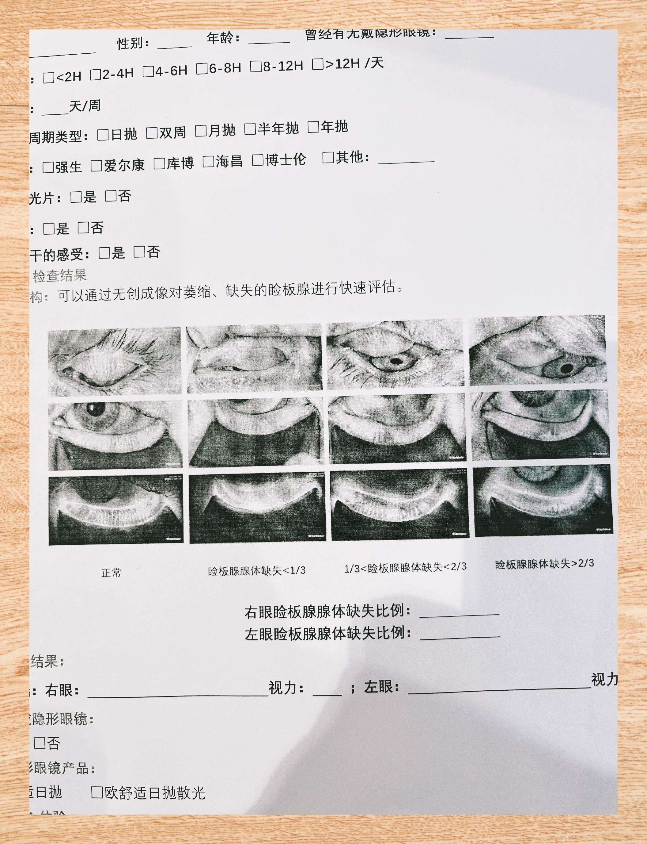 裂隙灯下眼睛图解手绘图片