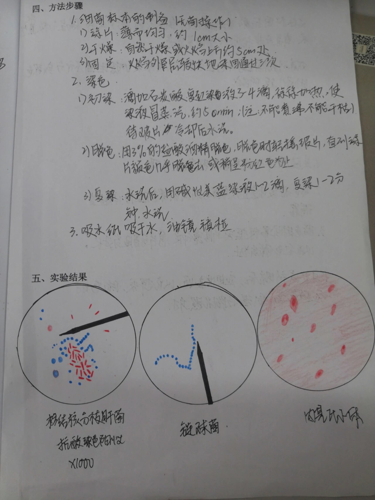 抗酸染色实验报告画图图片