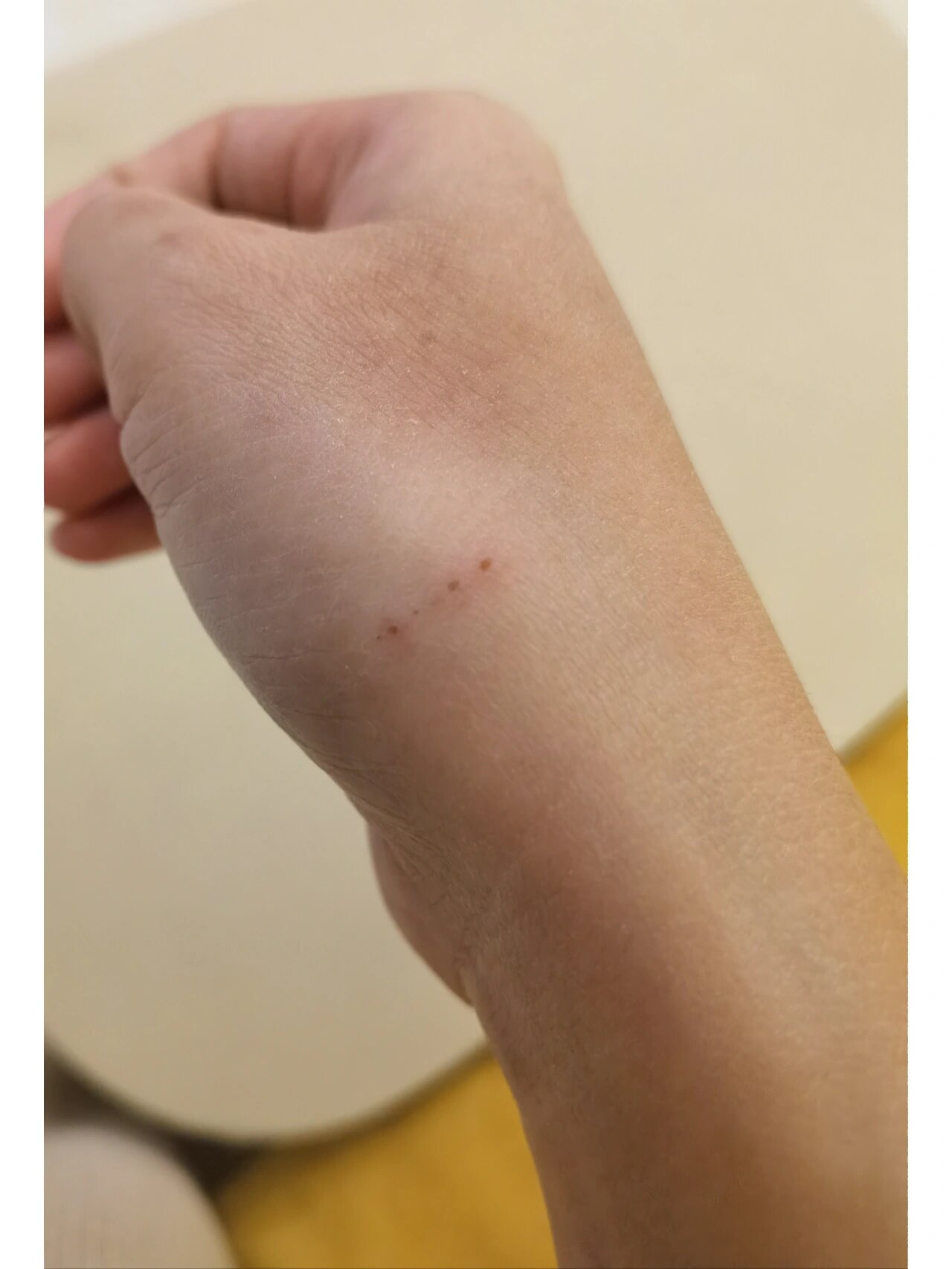 孕期被自家小奶狗抓了