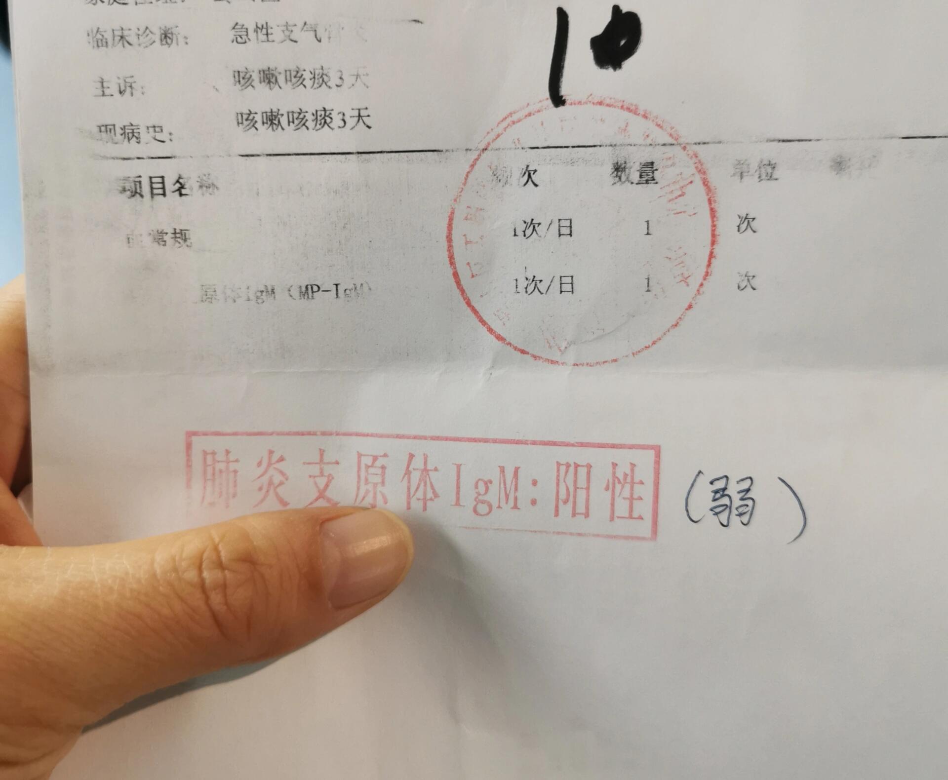 支原体弱阳,不发烧咳嗽.