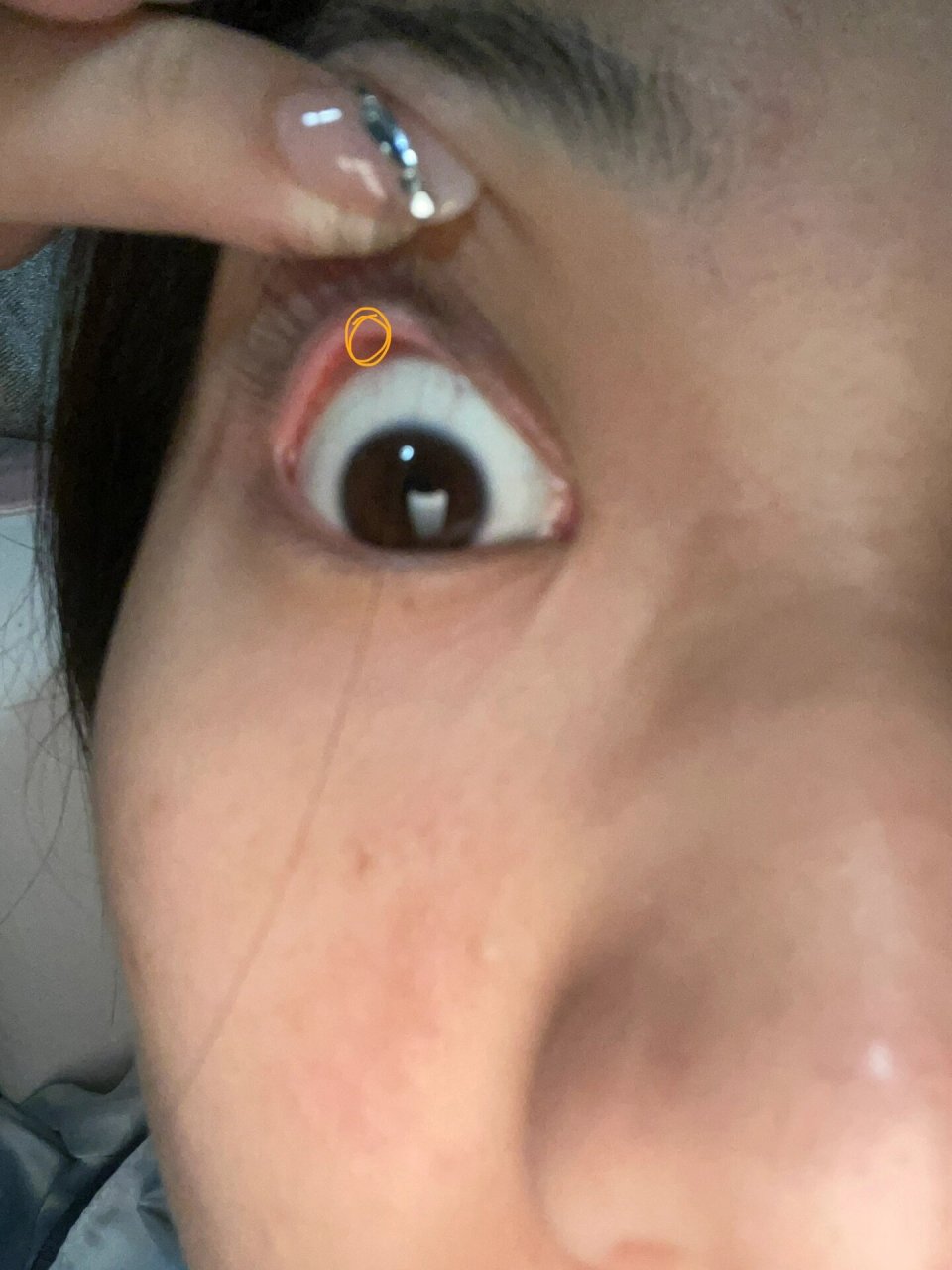 宝宝们上眼睑长了个小白点点怎么回事 今天画了个小妆出去玩 晚上卸完