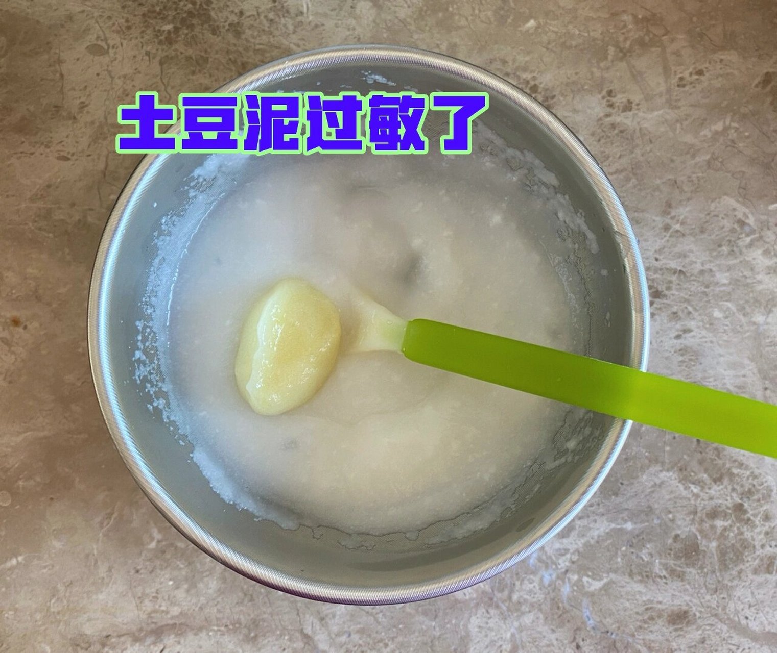 六个月宝宝土豆泥过敏了,原因居然是 我们宝宝是六个月开始吃辅食的