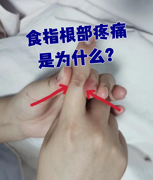 食指根部疼痛最常见的原因是掌指关节或屈指腱鞘的问题