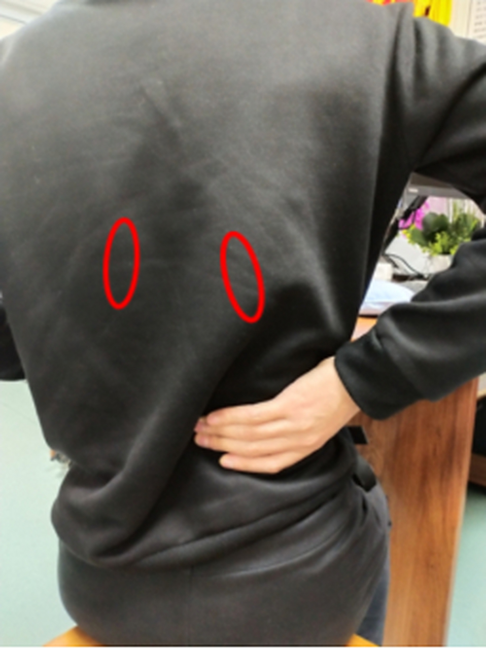 你可能一直搞错了肾的位置 你以为肾的位置vs其实肾的位置 你以为的肾